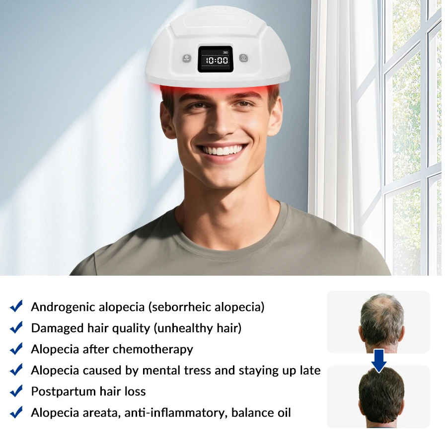 

2026 Mdical Hair Growth Helmet 650nm for Balding Man and Hair Fall Women LLLT Best LED Red Light Therapy Caps