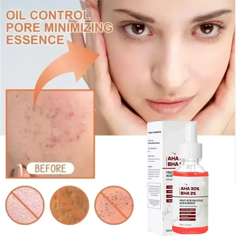 

Salicylic Acid Shrink Pores Serum For Acne Blackhead & Pores Skincare Exfoliating Moisturizing Nourish Smooth Pores Essence