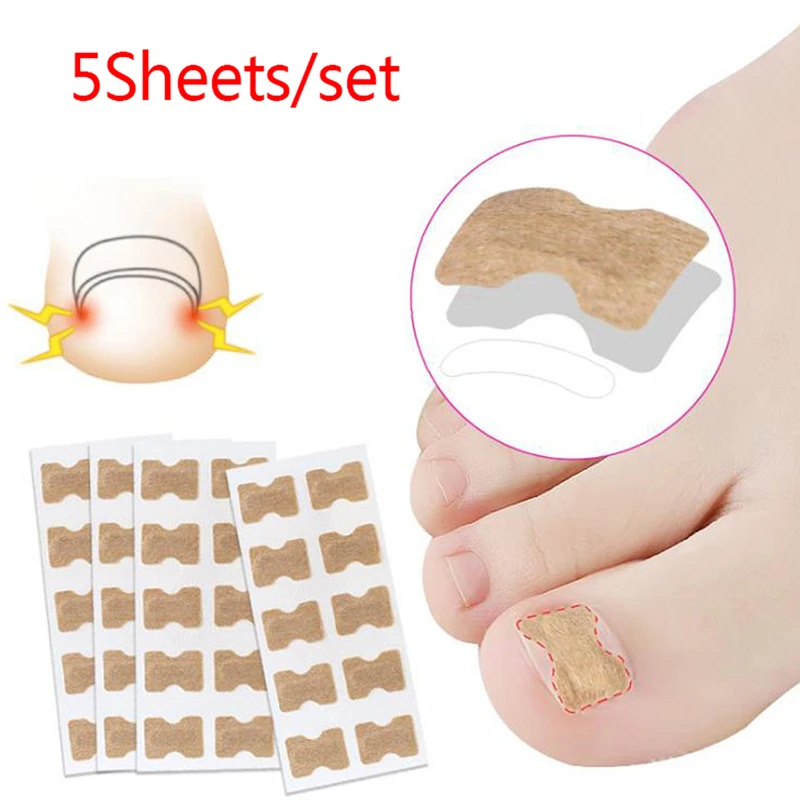 50Pc/5sheet Nail Art Ingrown Correction Sticker Foot Care Pedicure Tool Fixer Paronychia Recover Toenail Elastic Patch Corrector