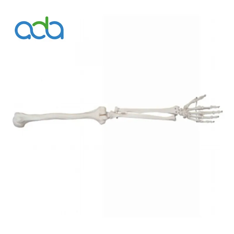 

Life-Size Upper Limb Skeleton Model BIX-A1031