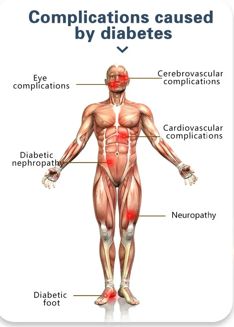 Home use diabetes treatment device magnetic acupoint therapy sugar control  diabetes medical neurotherapy device