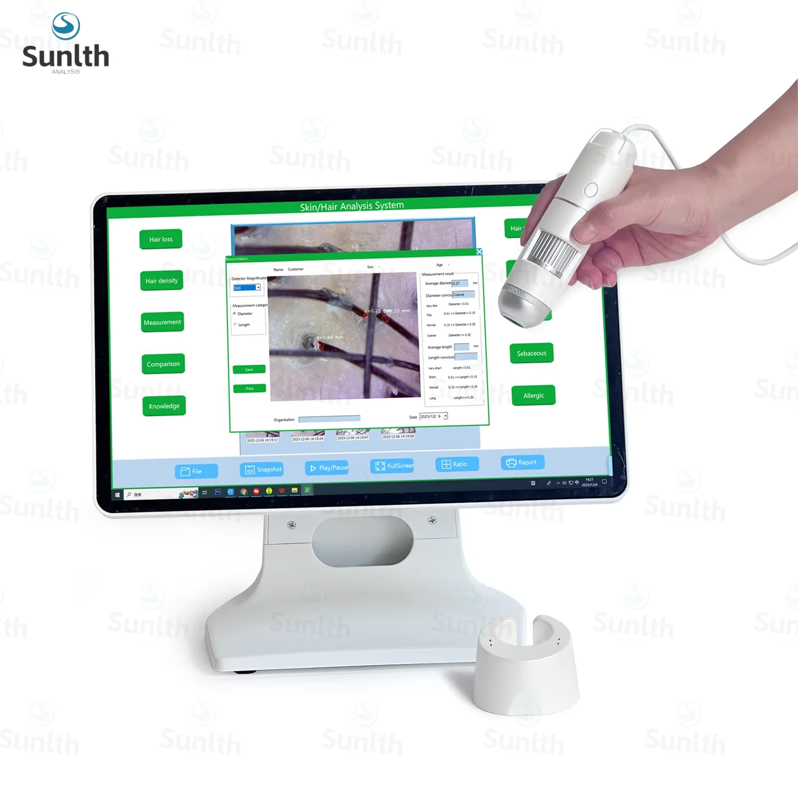 

Windows System with Report USB Connect Hair Follicle Scanning Handheld Skin and Hair Analyzer Microscope Magnifier with OTG