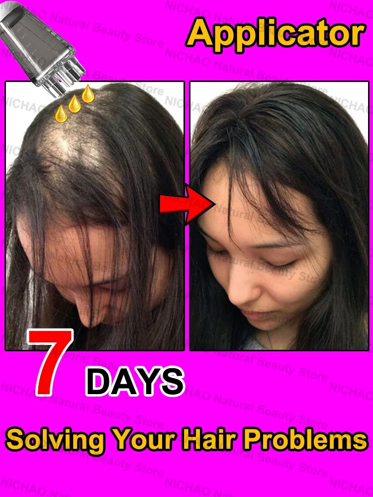 

7 Days Fast Hair Growth Essential Loss Regrowth Treatment Strengthens Hair Nourishes Scalp Light Weight Non Greasy