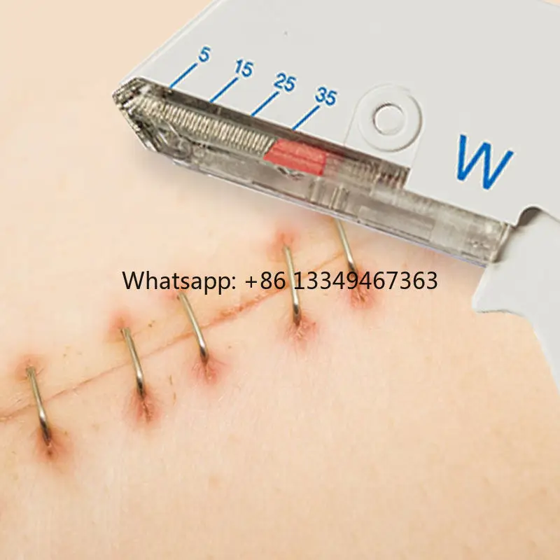 

Одноразовый хирургический степлер для кожи, 35 Вт, медицинское ручное источник питания, оборудование