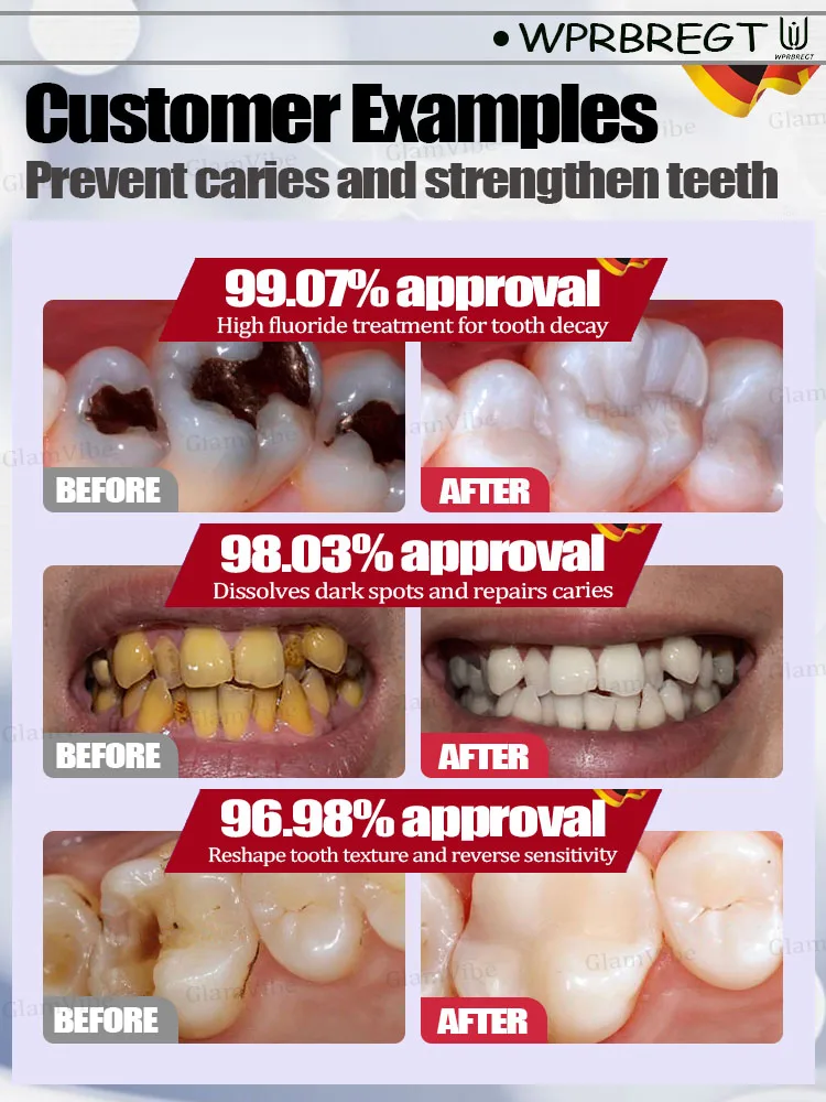 Tratamiento de caries con pasta de dientes