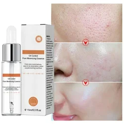 Pore Shrinking Serum Removing Large Pores Face Tightening Repairing Facial Pore Minimizing Get Rid Acne Marks Beauty Cosmetics