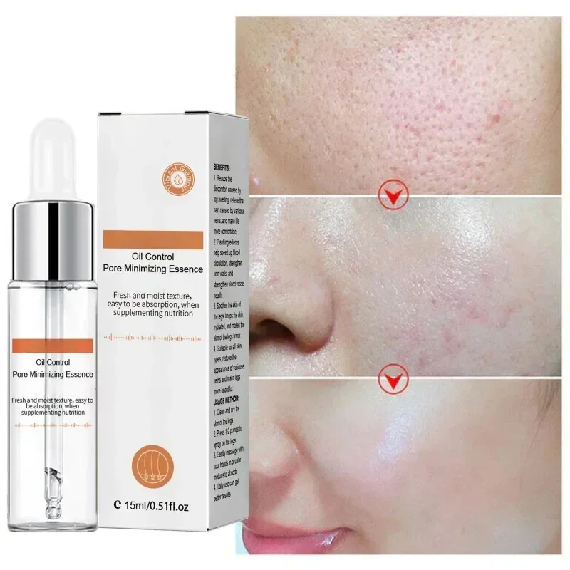 Pore Shrinking Serum Removing Large Pores Face Tightening Repairing Facial Pore Minimizing Get Rid Acne Marks Beauty Cosmetics