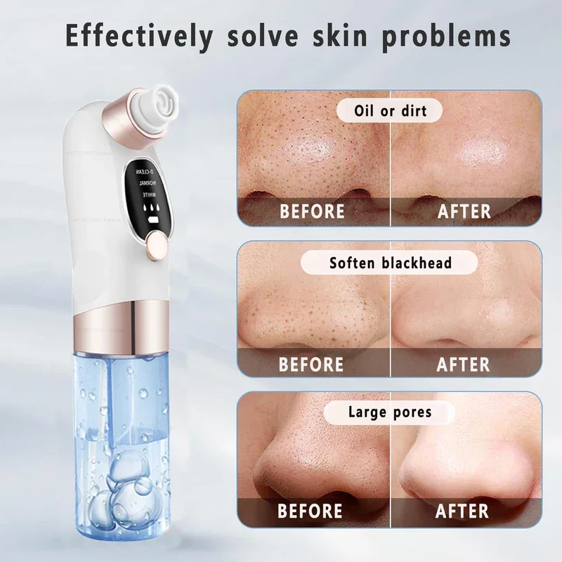 Blackhead Remover Pore Vacuum Face Cleaner Electric Pimple Acne Black Head Removal USB Rechargeable Water Cycle Black Dot Remove image 5