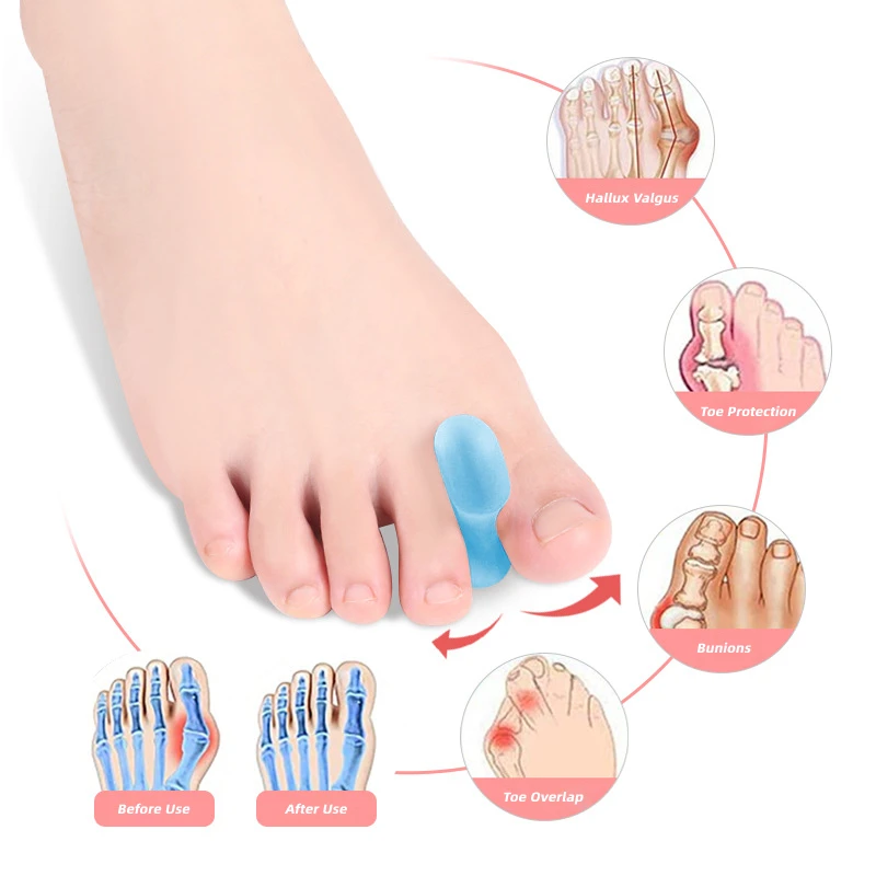 

2Pcs=1Pair Gel Toe Separator Soft Silicone Straightener Fingers Valgus Hallux Bunion Protector Orthopedic Corrector Foot Care