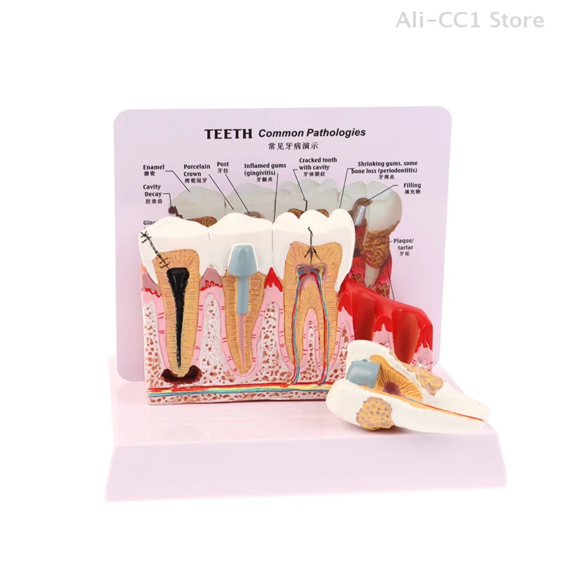 Standard Dental Oral Teeth Anatomical Teaching Model Comprehensive Tooth Structure Model Dentist Dental Student Demonstration