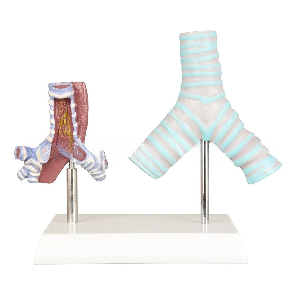 

Airway Comparison Demonstration Model between Healthy and Smoking People Airway Comparison Model