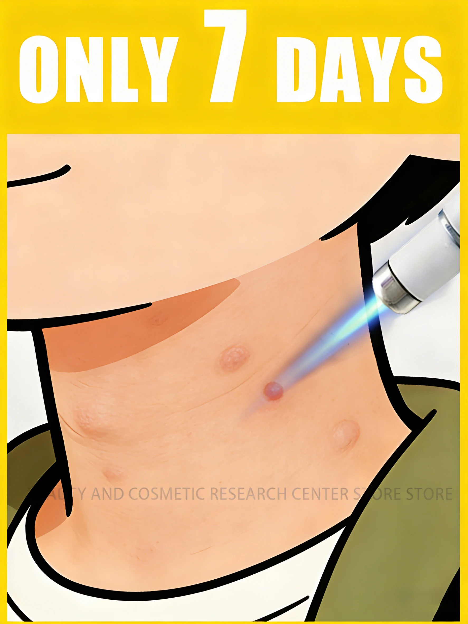 

Восходятся естественно, не оставляет любой шрамы, безболезненно и без любых следов.