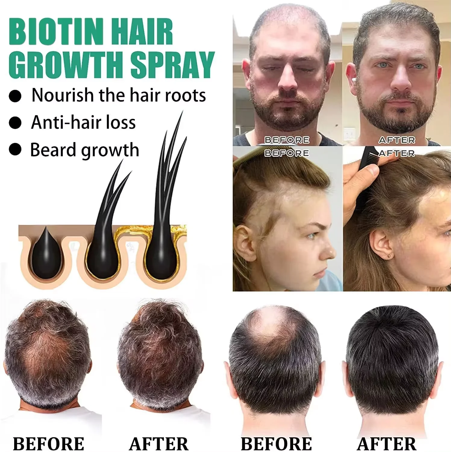 Biotin Hair Growth Serum Anti Hair Loss Fast Growing Products Prevent Dry Frizz Damaged Repair Treatment Scalp Beard Care Spray