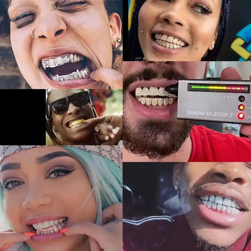 American grill hip hop super handsome braces