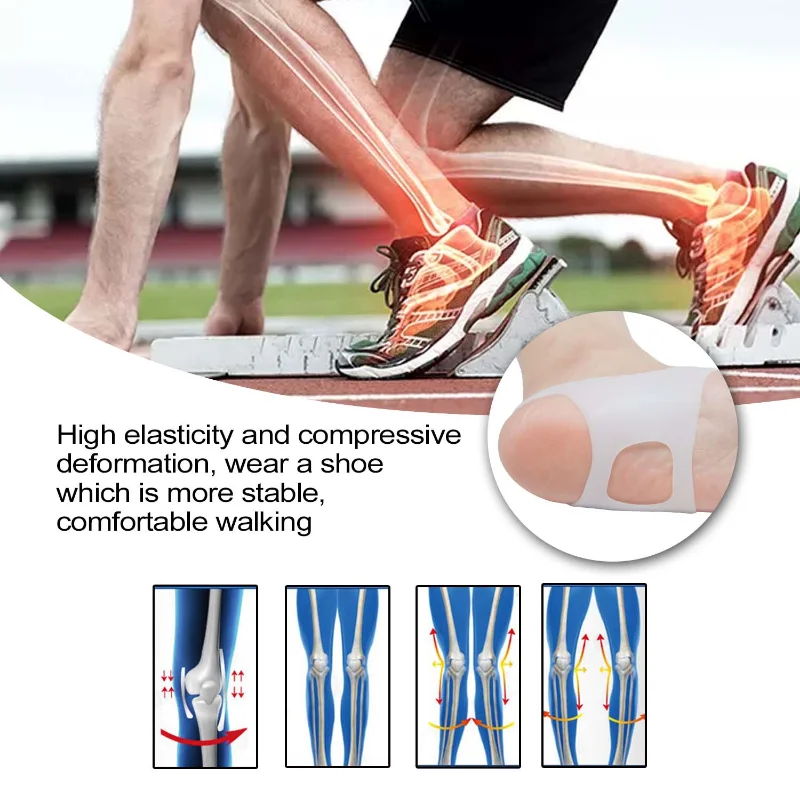 Plantillas correctoras de pies tipo O, almohadillas antideslizantes para hombres y mujeres, plantillas ortopédicas de silicona, herramienta para el cuidado de los pies, 1 par