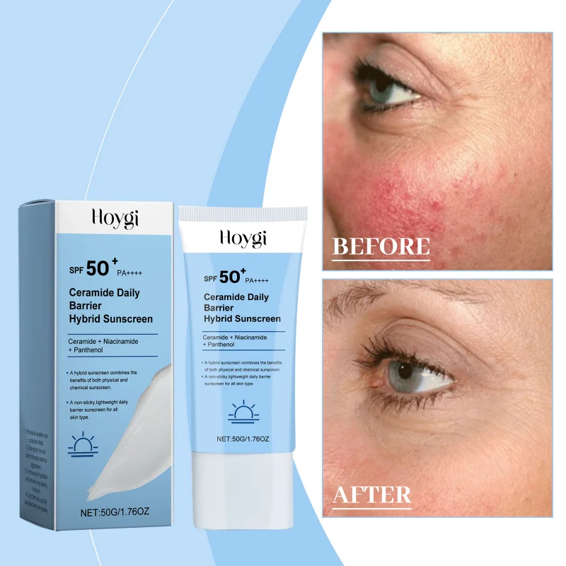 

Refreshing Ceramide Cream - Summer Moisturizing Skin Repair, UV Isolation Sweat-Resistant, Multi-Function Protection