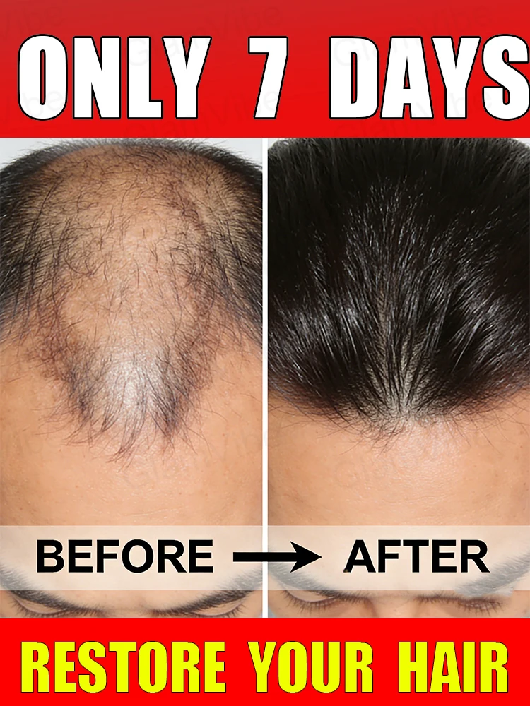 

Попрощайтесь с истончением волос и снова получите густые, шелковистые пряди, восстанавливая свою молодость и уверенность!