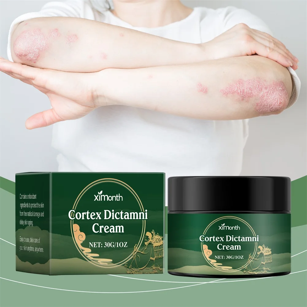 

Травяная мазь против зуда, облегчение раздражененной кожи, крем для восстановления кожи, нежное быстрое облегчение покраснений кожи, жидкости против зуда