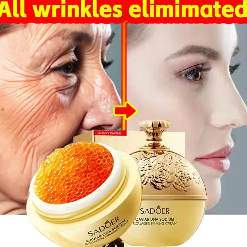 Caviar Anti-Wrinkle Face Cream Removal Facial Serum Rejuvenation Lift Firm Anti-aging Whitening Invisible Pore Beauty Skin Care