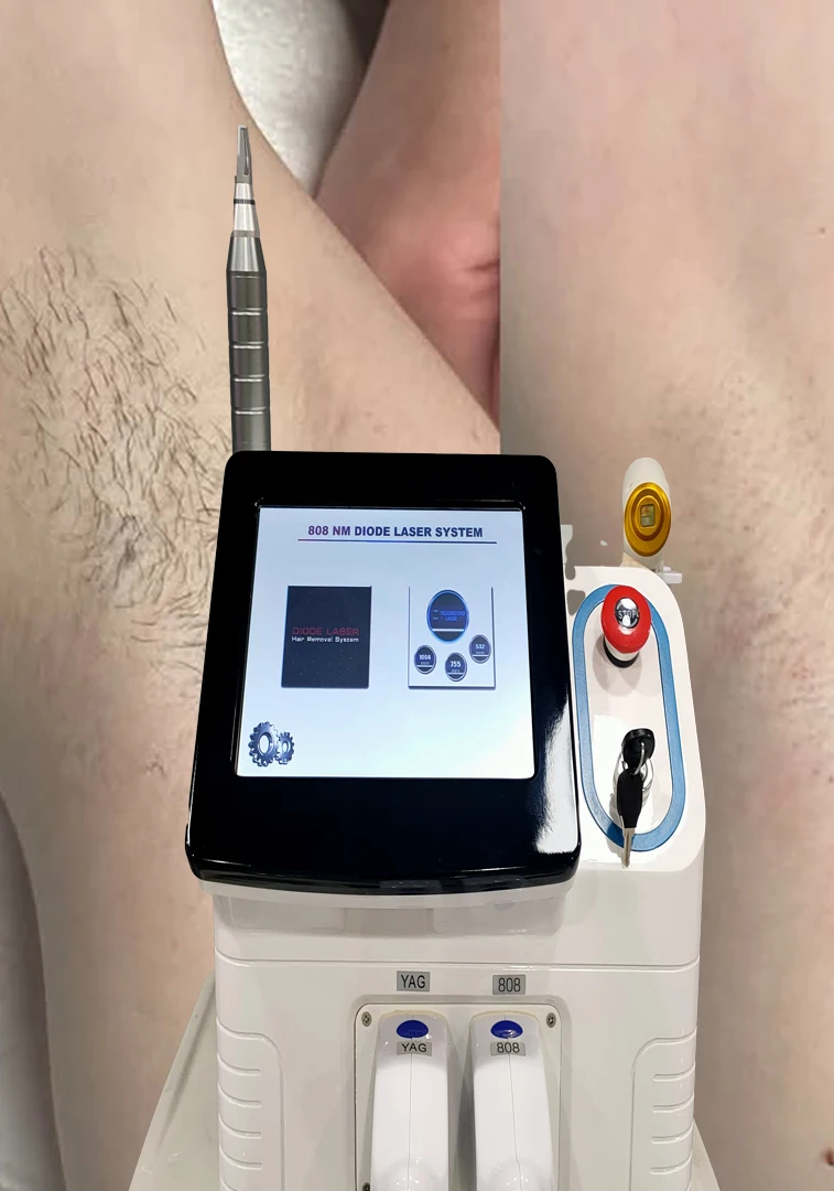 

Diode Laser Permanent ND yag Picosecond Pigmentation Electrolysis Hair Reduction Device