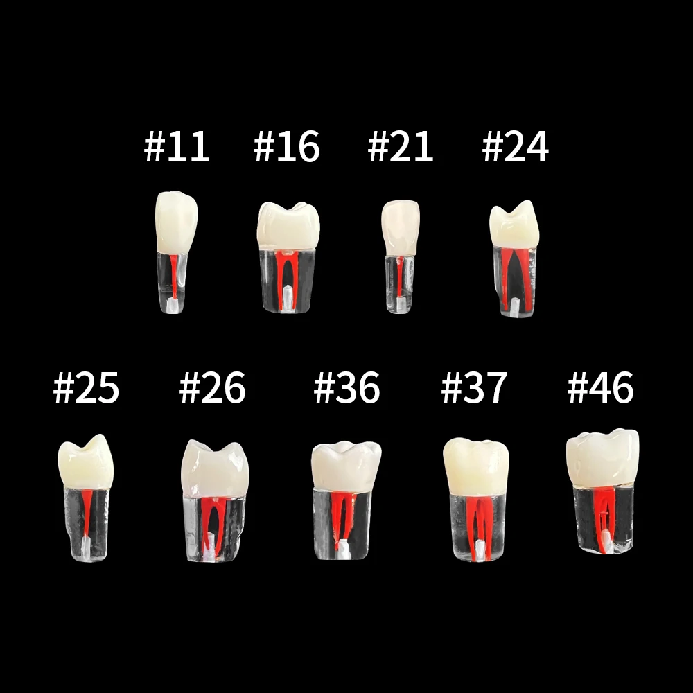 1 szt. Model nauczania zębów żywica endodoncja kanału korzeniowego do wypełniania blok treningowy RCT Model praktyczny dentysta studiujący uczeń