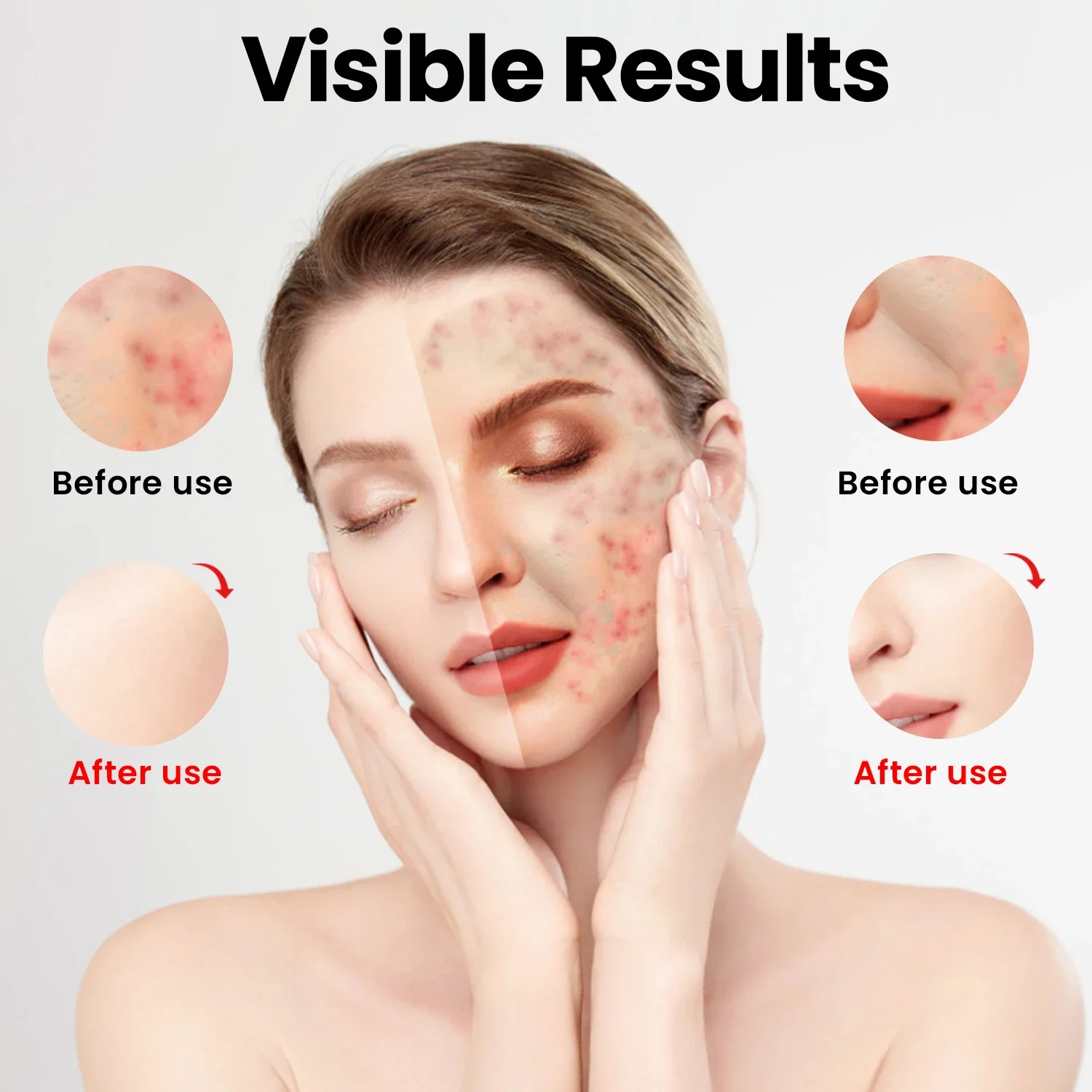 4-colour silicone LED face and neck mask (listing 3765), view 3