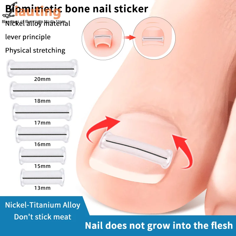 2Pcs Nagel Korrektur Aufkleber Eingewachsene Zehennagel Corrector Patches Paronychie Behandlung Erholen Corrector Pediküre Werkzeuge Fuß Pflege