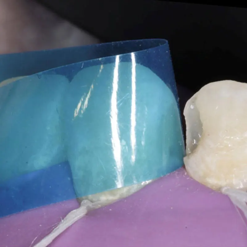 50/pudełko Dental Blue View przednia żywica odbudowująca opaski matrycowe Trans pasek anatomiczny matryce matryca podobna z VariStrip