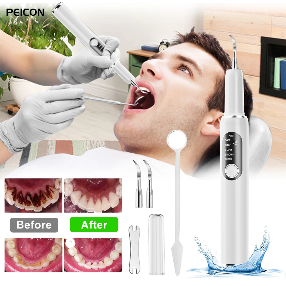 

Ultrasonic Dental Calculus Remover Teeth Plaque Stains Cleaning Machine High Frequency Vibration Dental Calculus Tartar Cleaner
