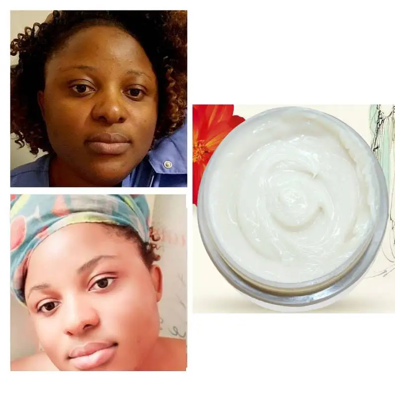 

Extra Strong Lightening Body Face cream 1oz. Whitening Kojic Acid,Arbutin,Niacinamide,Hylauronic acid, Dark Spot