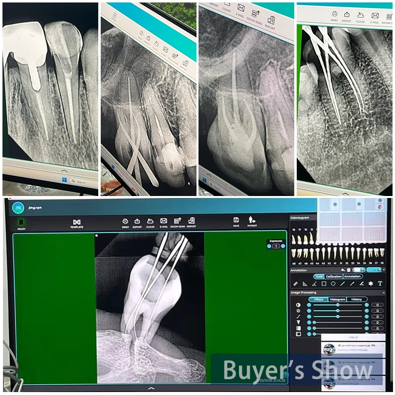 LK-C66A RVG Portable Periapical Xray Intraoral Sensor Equipment Dentl Digital Camea Machine Price