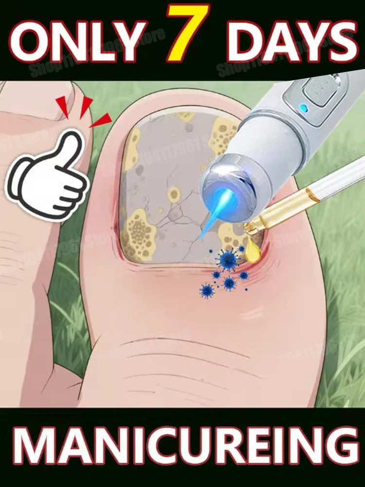 2025  Nail Cleaning Tools, Blue Light Laser Tools Root Repair Upgraded to Second Generation