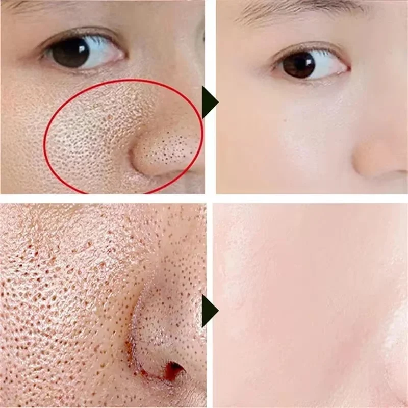 Salicylic Acid Pore Shrinking Cream Quick Elimination Large Pores Remove Blackehead Tighten Face Smooth Skin Korean Care Product view 4