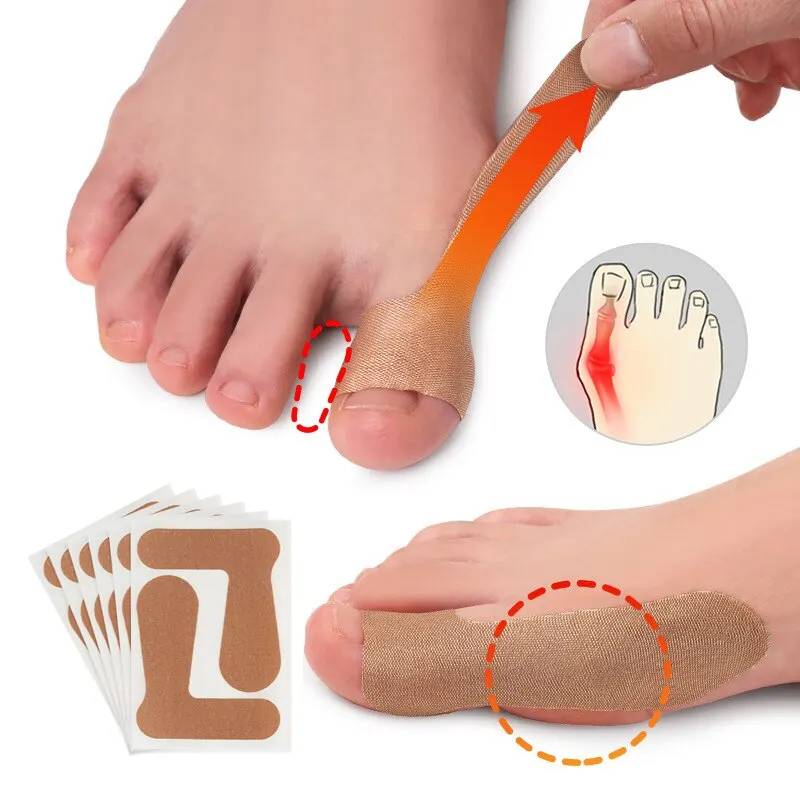 Thumb Correction Patch Big Toe Corrector Adjuster Finger Toe Patch Protector Hallux Valgus Orthopedic Sticker