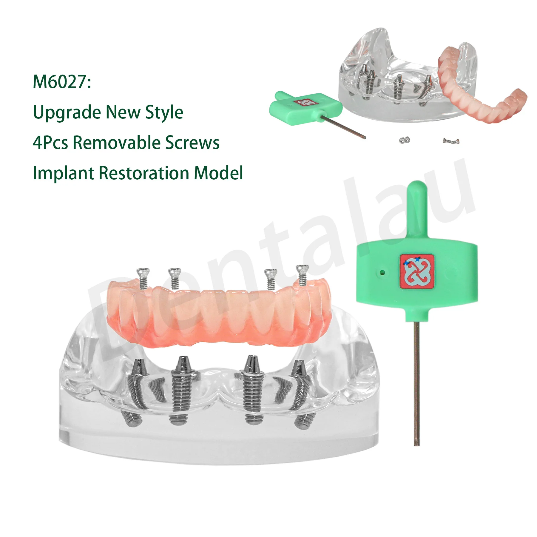 

Модель для коррекции зубных протезов с нижней челюстью и стоечным мостом, 4 винта M6027