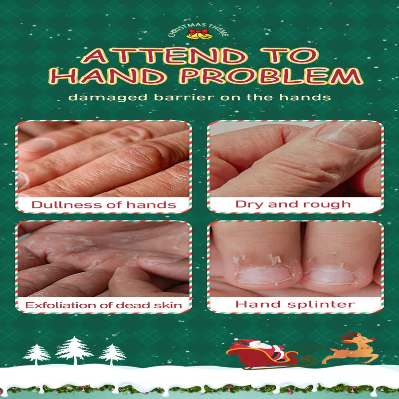 5 عبوات من كريم اليد لحماية الأيدي الجافة والمتشققة، لوشن مرطب لليدين مناسب للعناية بالبشرة باليد المجففة والتجاعيد الجافة