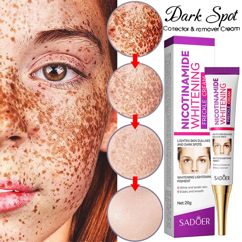 Nicotinamide Whitening Freckles Cream Effectively Lightening Dark Spot Acne Marks Remove Melasma Face Brightening Skin Care