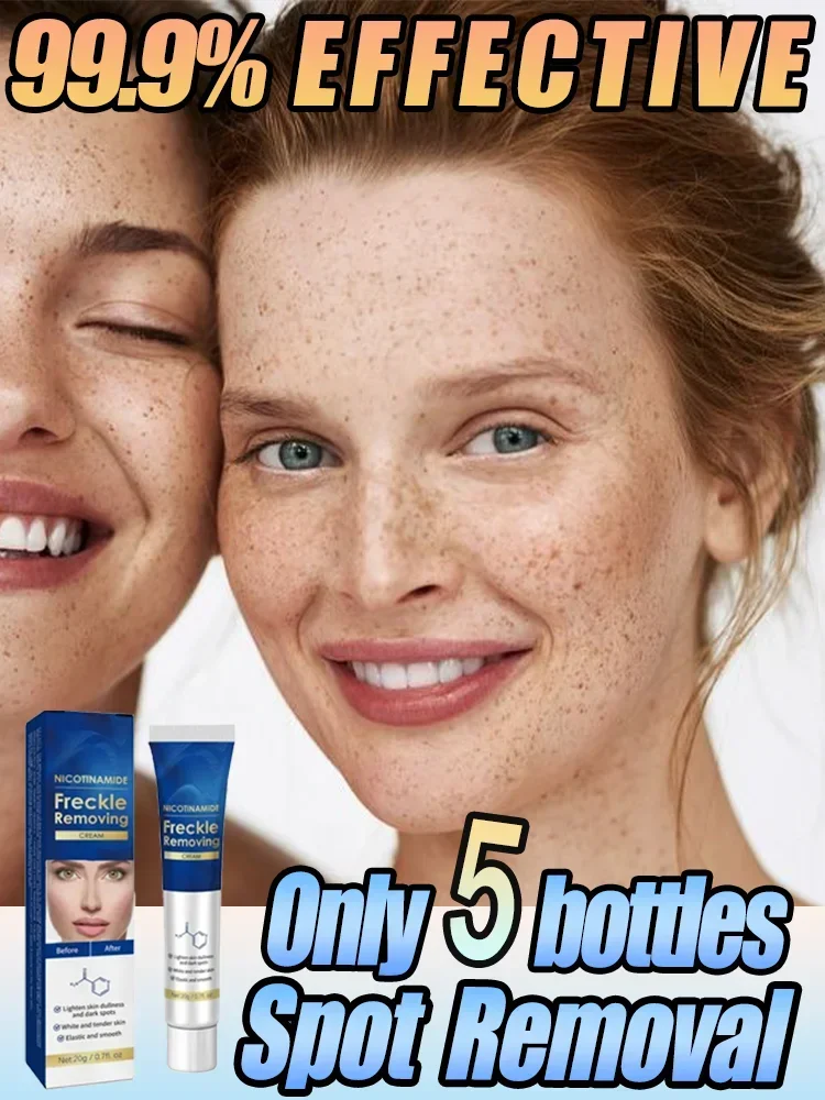 

Effictive Dark Spot Remover cream for Face Removing Freckle Melasma Chloasma Senile Plaques Sunburn Cyasma Chorioplaque Freckle