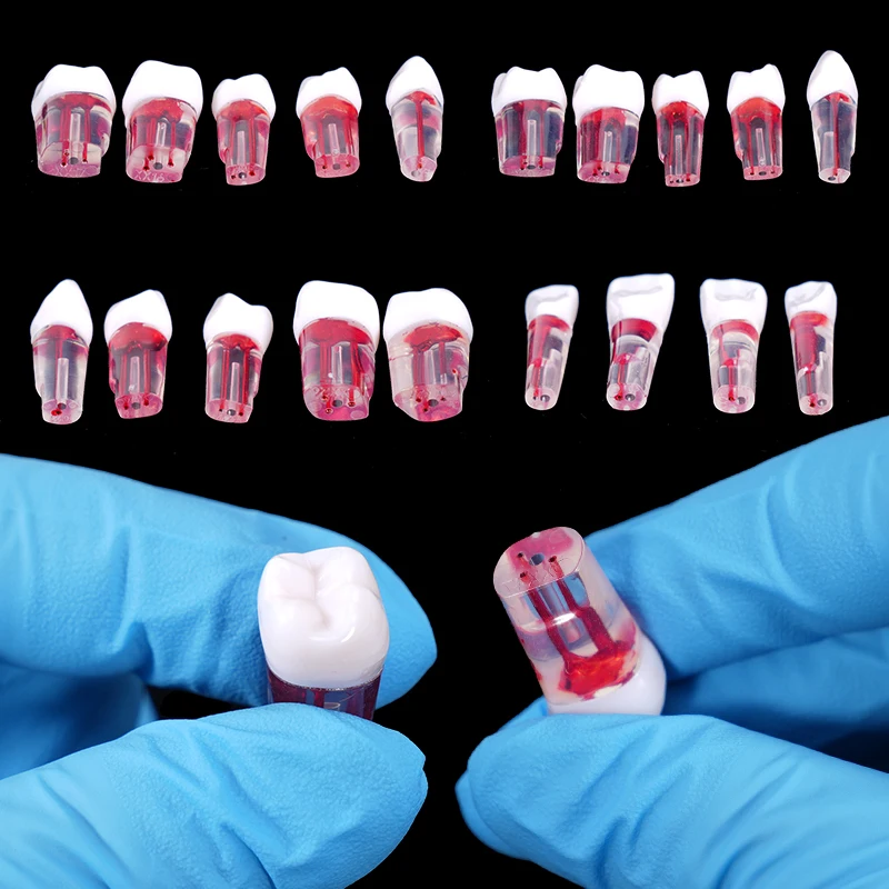 

28Pcs/set Dental Endodontic Teeth Model Red RCT Pulp Cavity Practice Block Endo Root Canal Model for Filling Teaching