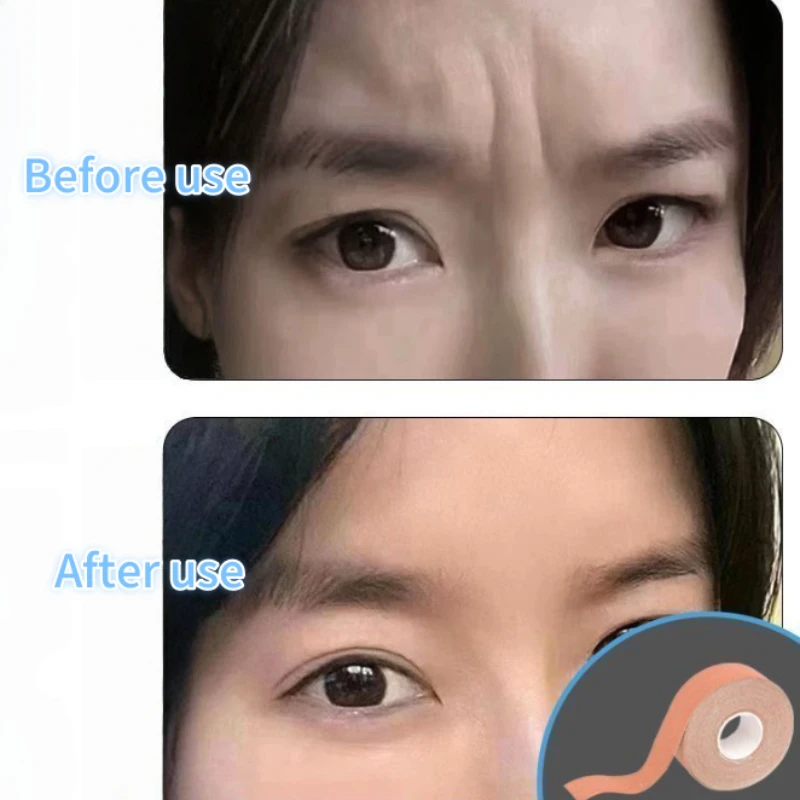 2 ม้วนเทปยกกระชับใบหน้าวีไลน์คอตาลดริ้วรอยบนใบหน้าระบายอากาศได้ดีรองรับผ้าพันแผลยืดหยุ่นใบหน้าเครื่องมือดูแลผิว