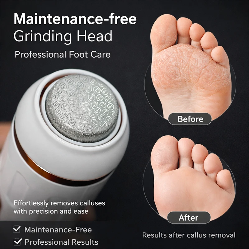 Electric Callus Remover Foot File Dry Skin Remover Dead Skin Eliminator Pedicure Exfoliator Tool for Home Foot Care 2026 New - view 2