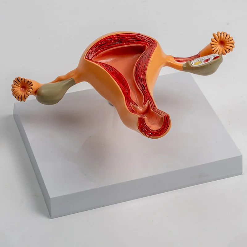 

Модель патологической матки человека, модель яичника, женский орган, анатомическая анатомическая модель, медицинское обучение