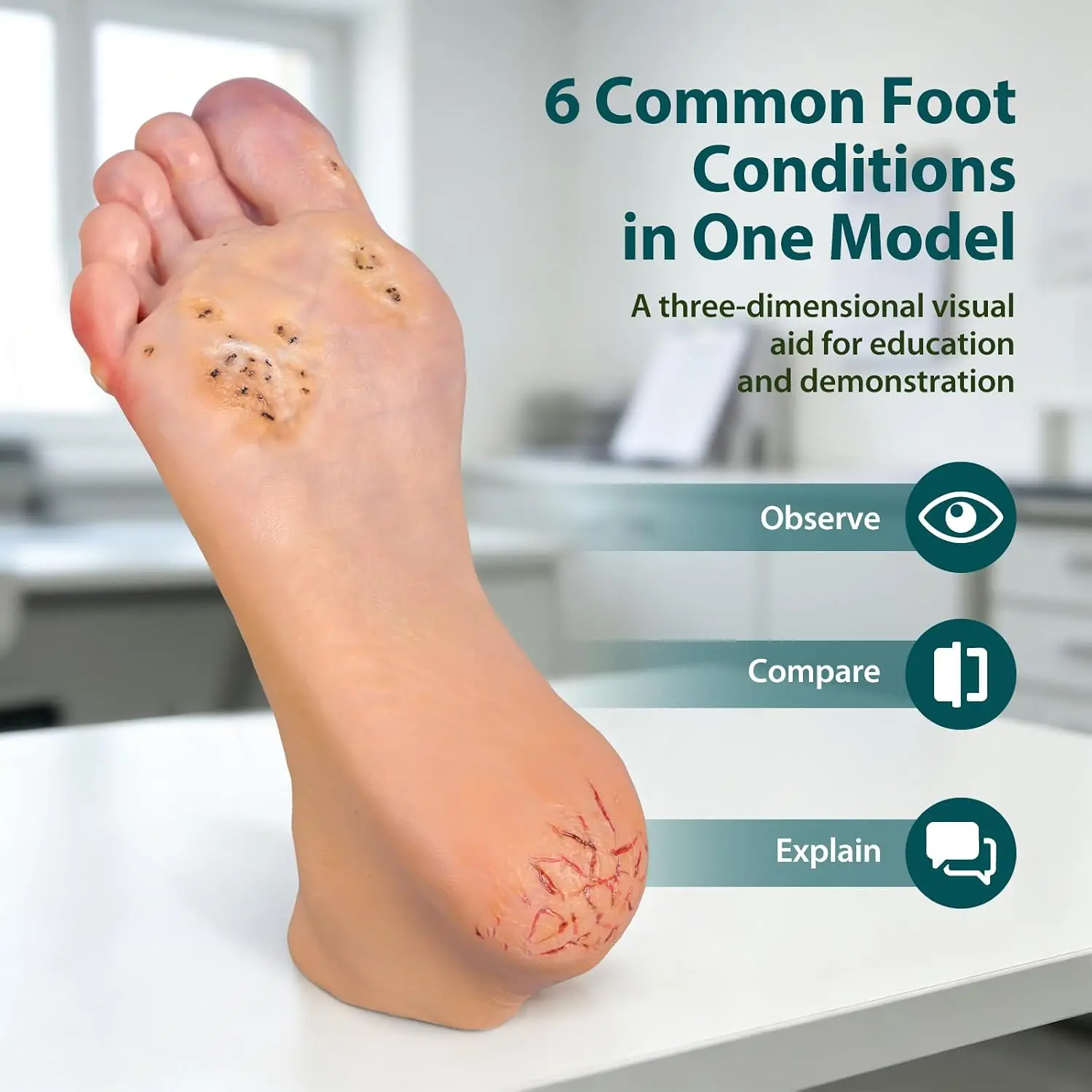 Ultrassist Foot Pathology Model Simulate 6 Common Foot Conditions Bunion Corns Ingrown Toenails for Medical Student Education