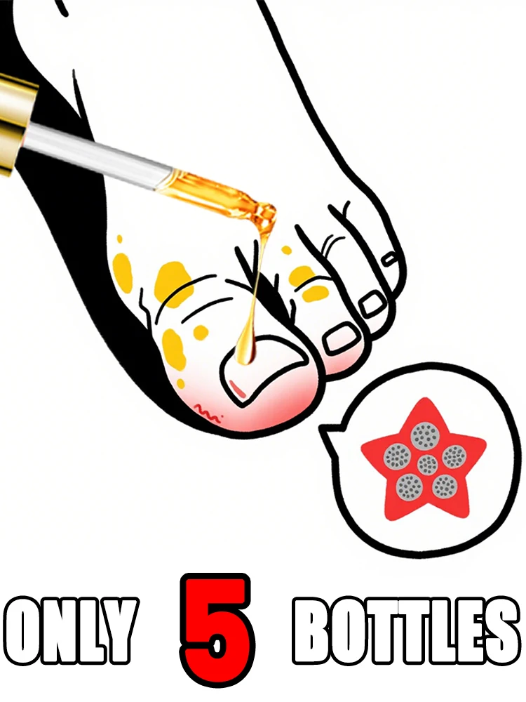 

Hot-selling nail oil, fungus removal