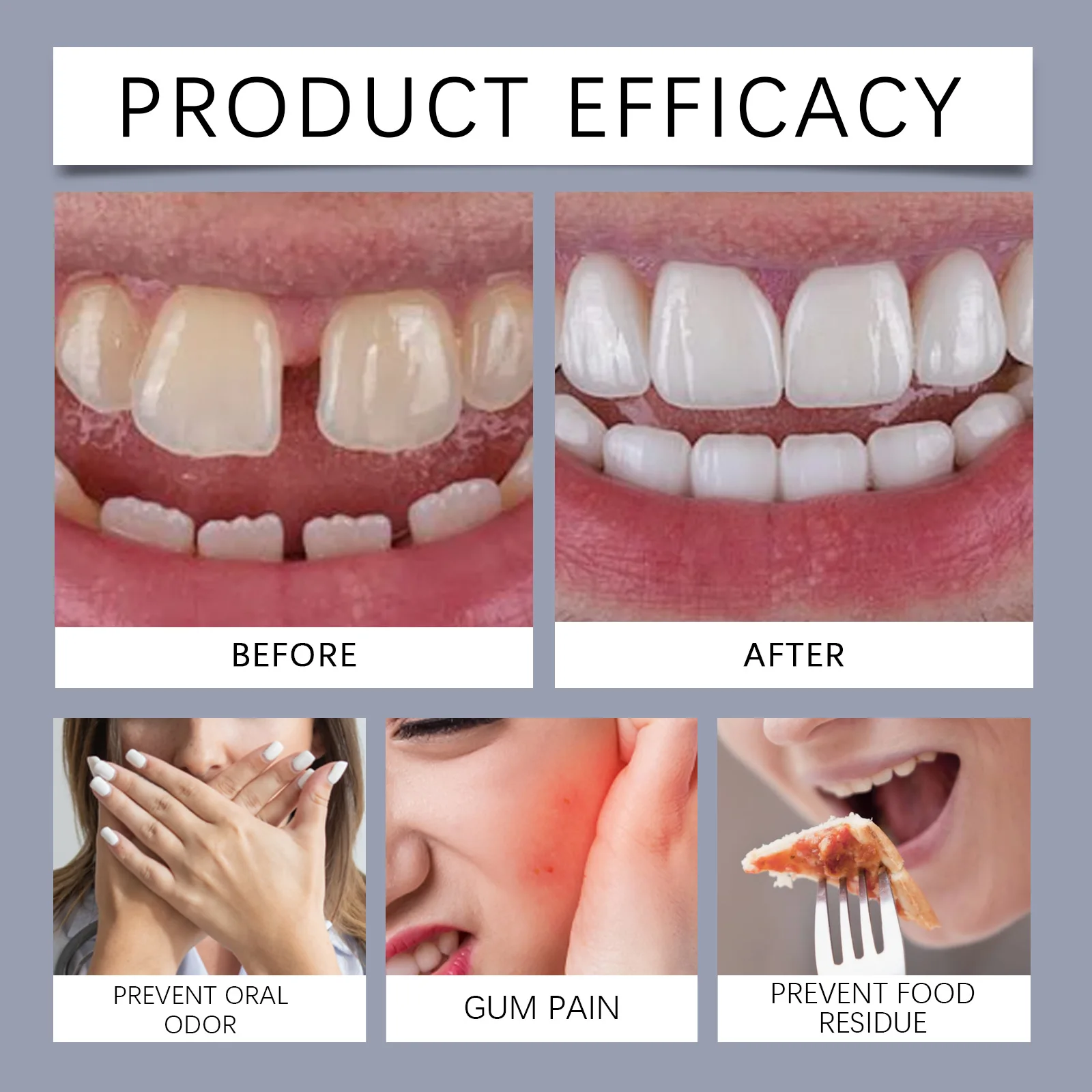 Denture Adhesive Cream, Premium Strong Hold Denture Fixative Cream, Safe Mild Formula for Full and Partial Dentures 40g