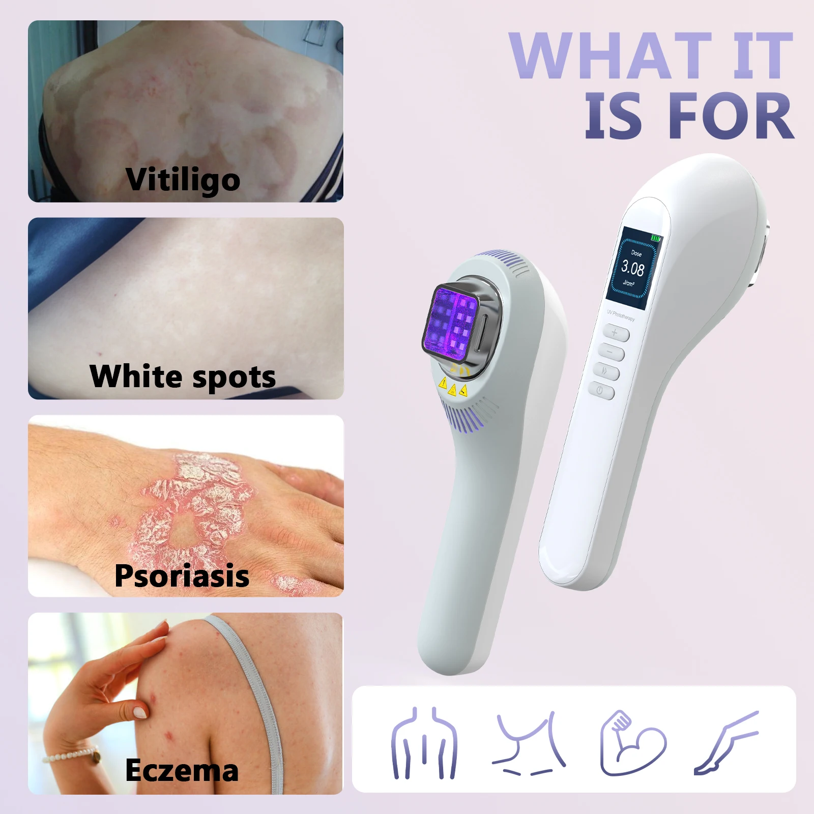 KTS lámpara de Vitiligo para uso doméstico, lámpara UVB de 308nm para fototerapia de Vitiligo, terapia de luz Para manchas de Psoriasis, Eczema,