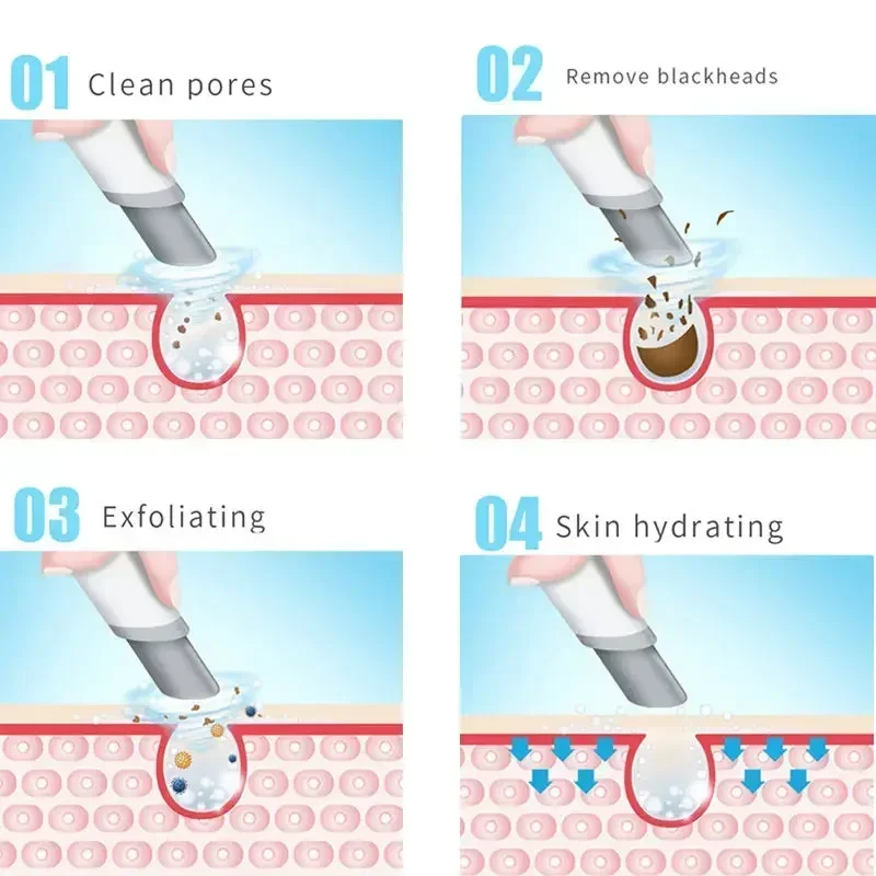 Multi functional portable facial tightening and lifting skincare machine