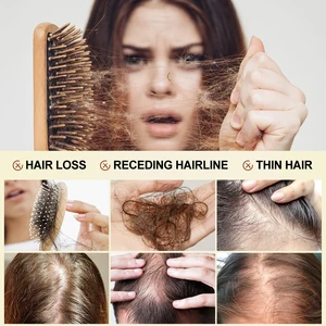 Haarwachstums Shampoo Conditioner Set Biotin, Anti -Haar -Behandlung für Männer und Frauen, schnell verdickter, bereue Öl, Schönheit Gesundheit, Purc 12 Hauptverkäufe Copaiba Oil - №3