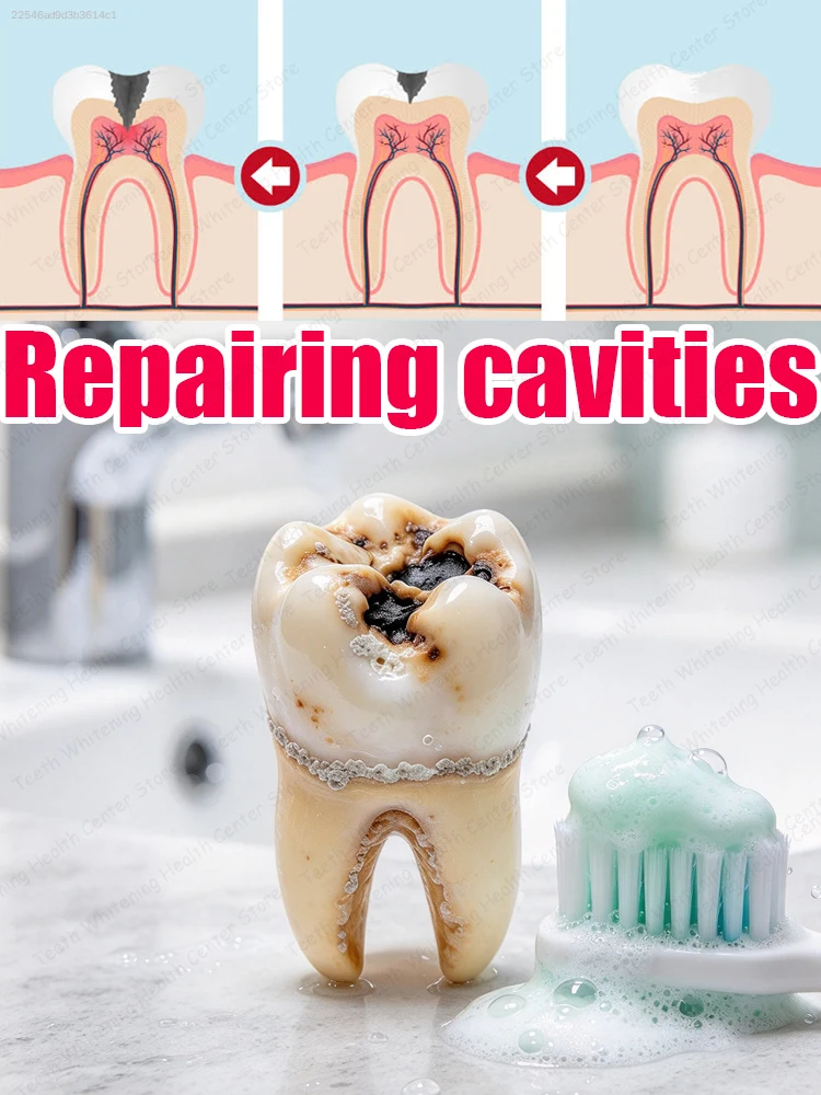 Gentle Whitening Anti Cavity Toothpaste Remove Plaque Prevent Tooth Decay Bright Smile