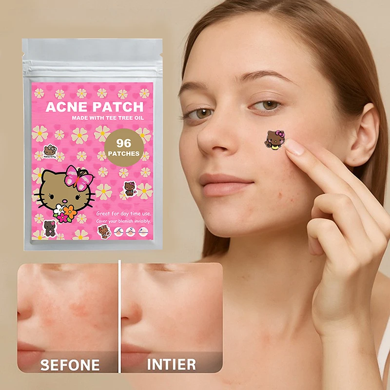 แผ่นแปะสิวรูปซานริโอ้ เฮลโลคิตตี้ 96 ชิ้น ลายการ์ตูนคุโรมิ แผ่นปิดสิวแบบใส ปกปิดสิว กำจัดสิว แผ่นแปะดูแลผิว